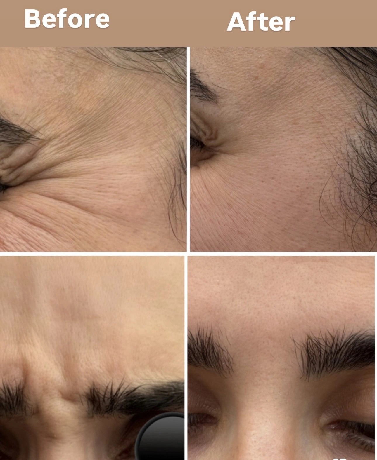 Before and after result 1