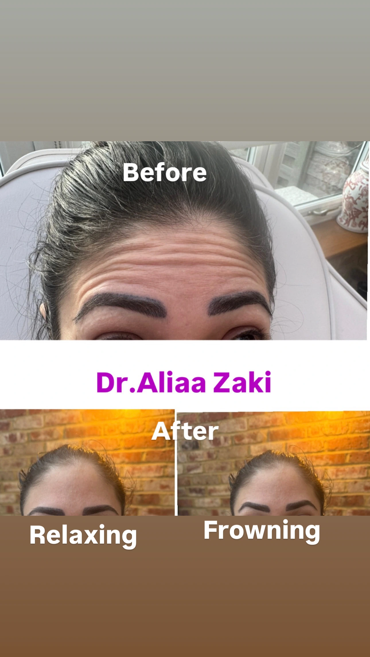 Before and after result 5