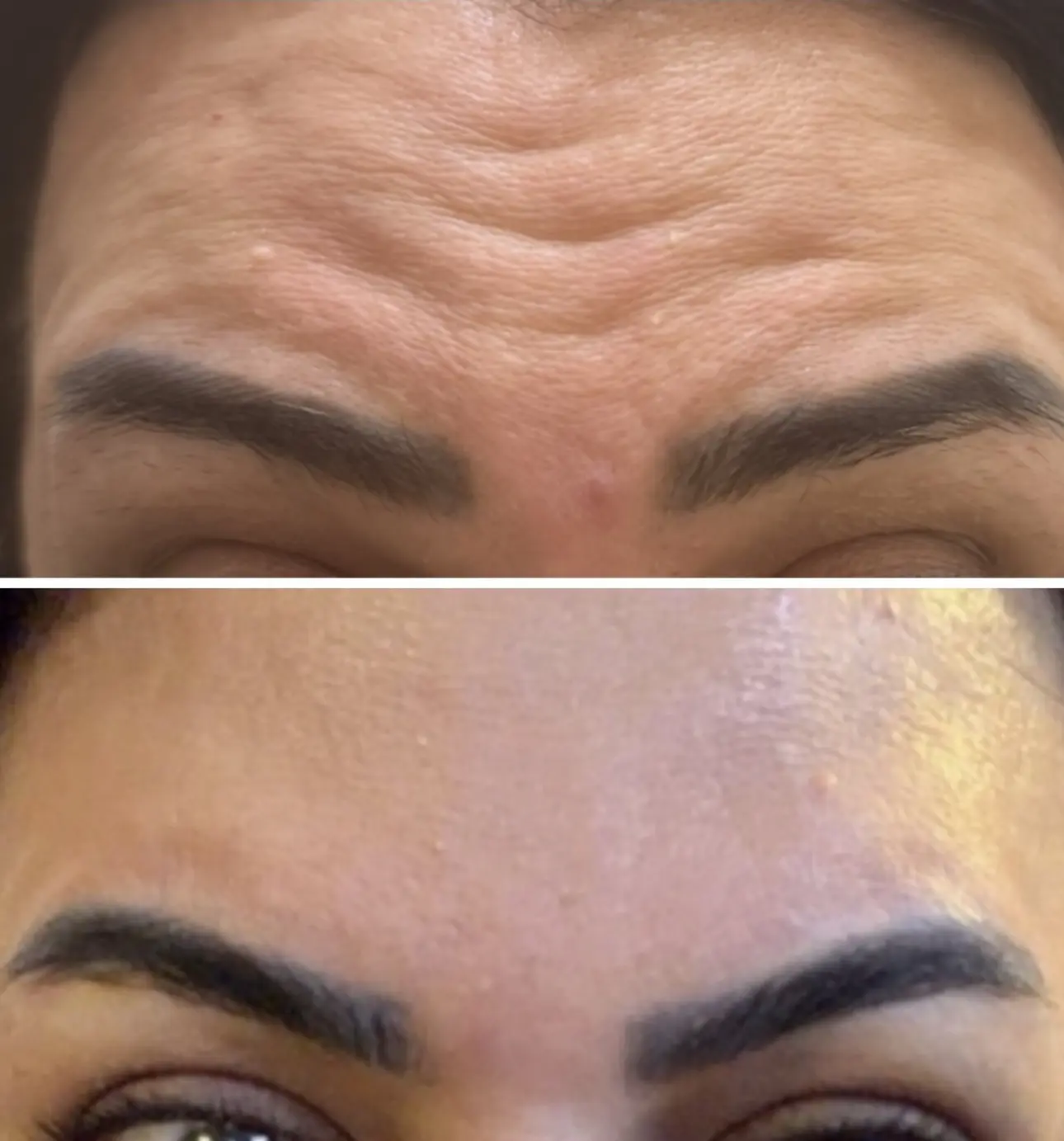 Before and after result 6