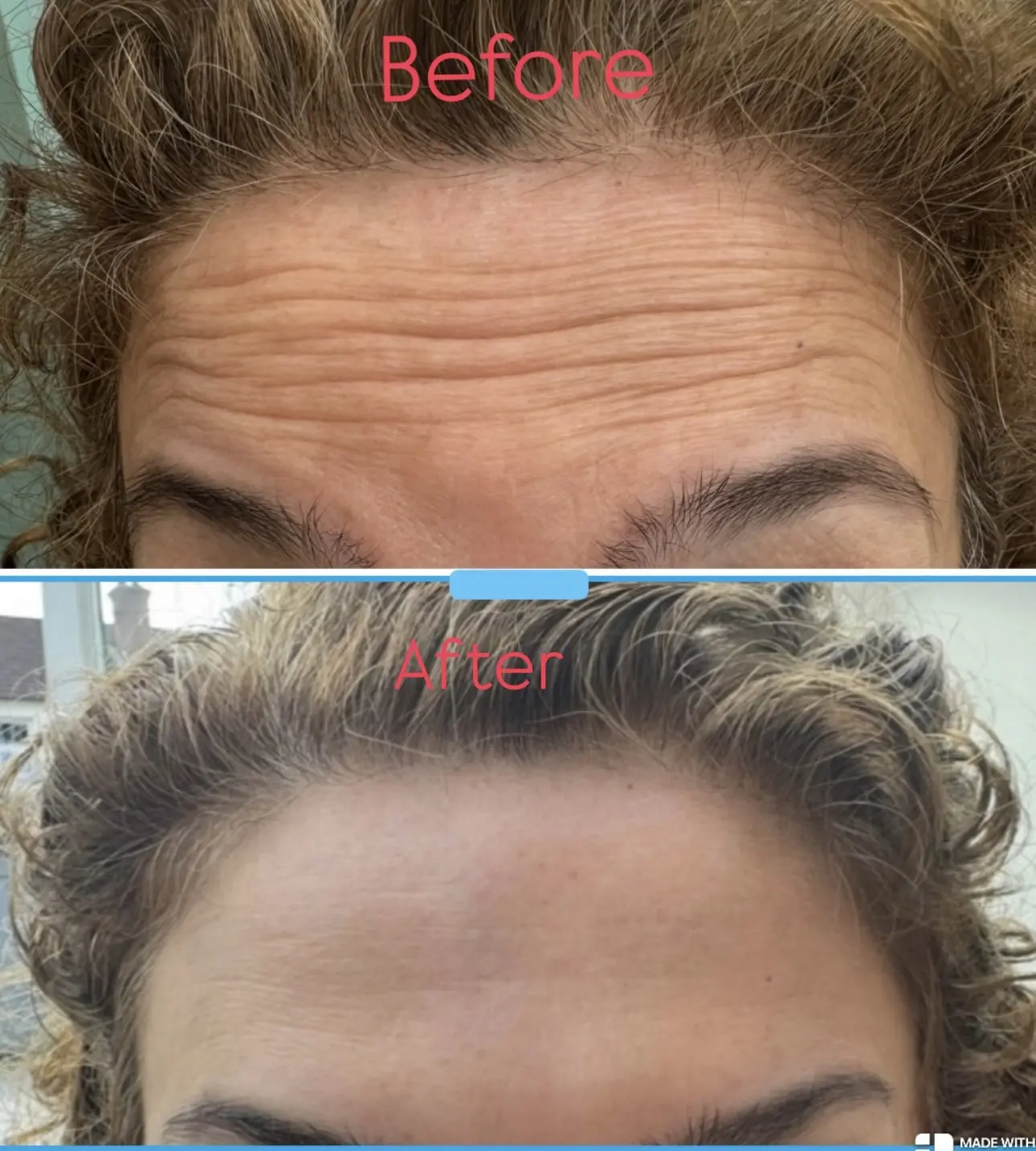 Before and after result 7