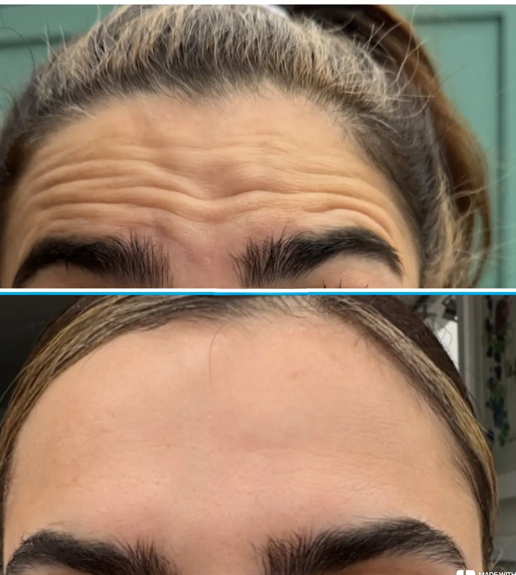 Before and after result 8